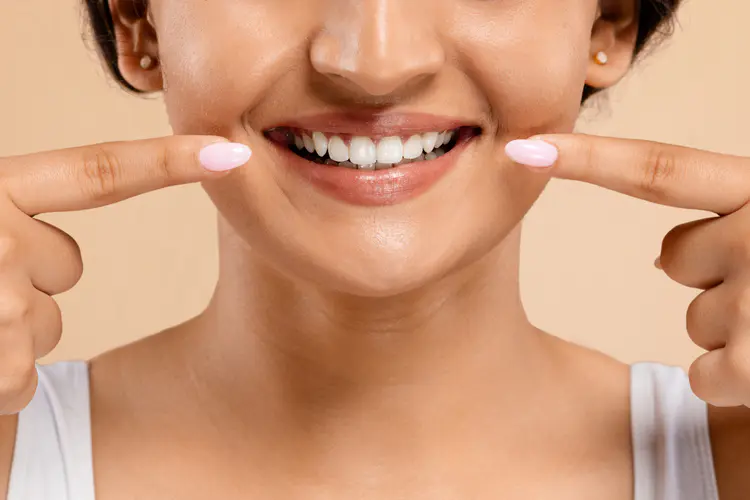 Smile Makeover in Frisco, TX