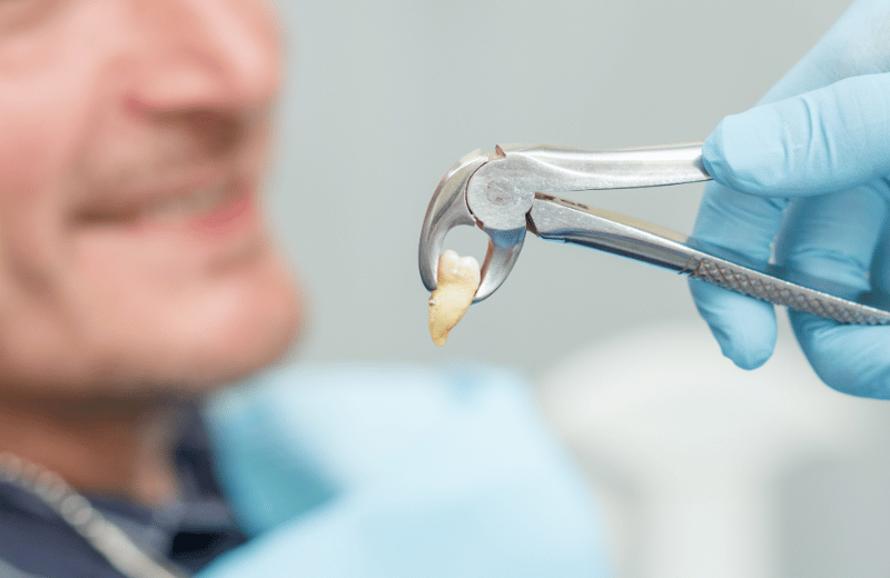 dental services in frisco tx