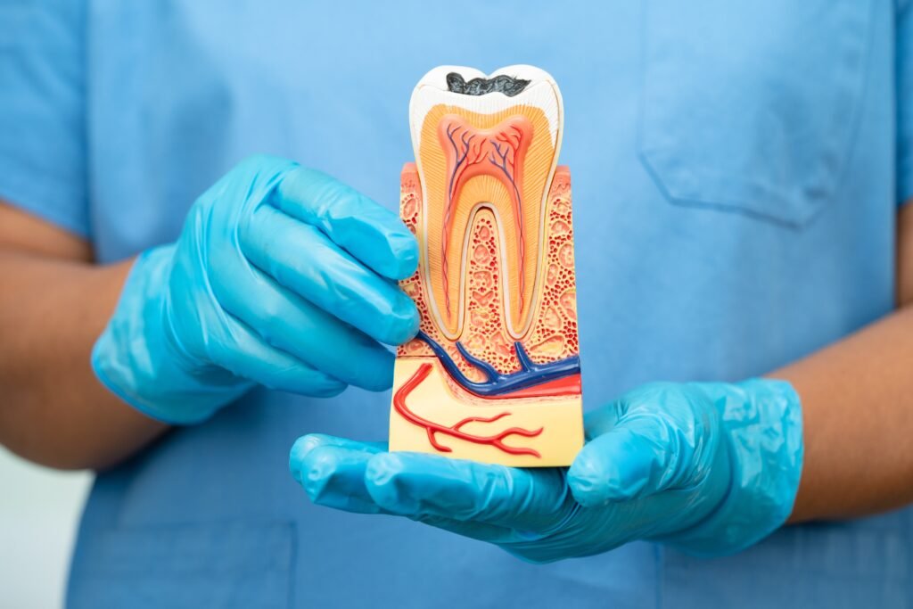 root canal treatment in frisco