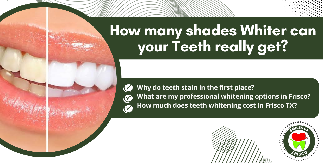 Teeth Whitening Frisco TX